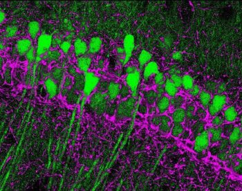 The CB1 cannabinoid receptors (magenta) surround hippocampal cells (green).